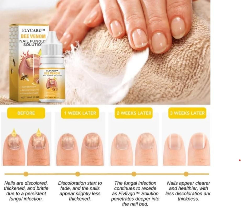 BeeVenom Nail Fungus Solution 10ml Each (Pack of 2)