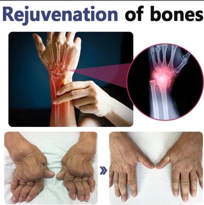 BeeZen Bee Venom Joint and Bone Therapy Advanced Cream 50gm (Pack Of 2)