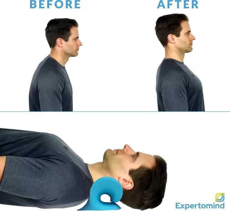 Expertomind Neck Relaxer Expertomind Neck Relaxer | Cervical Pillow | Neck & Shoulder Support for Pain Relief | Chiropractic Acupressure Massage | Durable and Soft | Portable & Easy to Carry - Blue Color Massager (Blue)