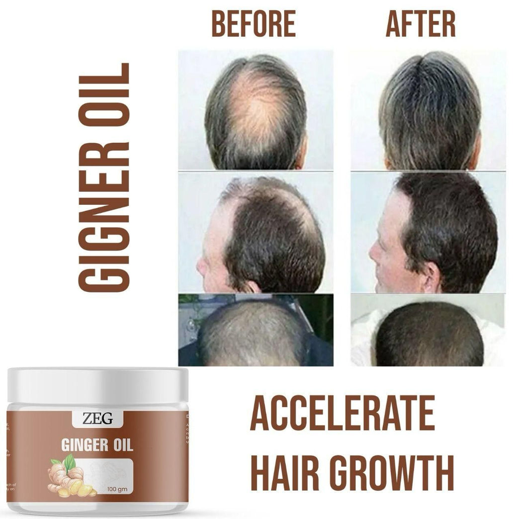 ZEG GINGER OIL 100GM ? 100% Natural Multipurpose Oil for Hair, Skin & Body (Pack of 2)