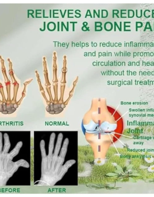 Bee Venom Joint and Bone, Pain Relief Therapy Cream