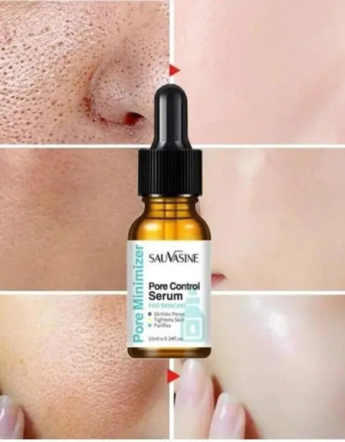 Face Serum Remover Blackheads Dark Spots Acne Treatment Oil Control Moisturizing