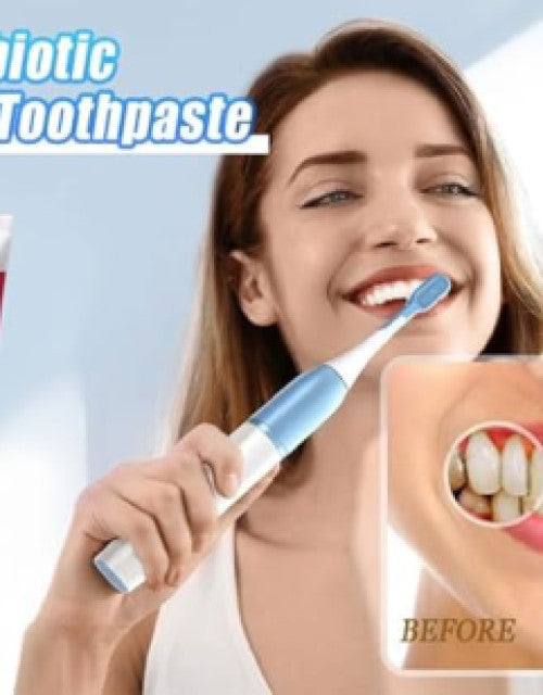 SP-4 Probiotic Whitening Toothpaste, Teeth Whitening Toothpaste