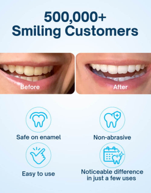 Teeth Whitening Powder - Dentist-Approved & Enamel-Safe