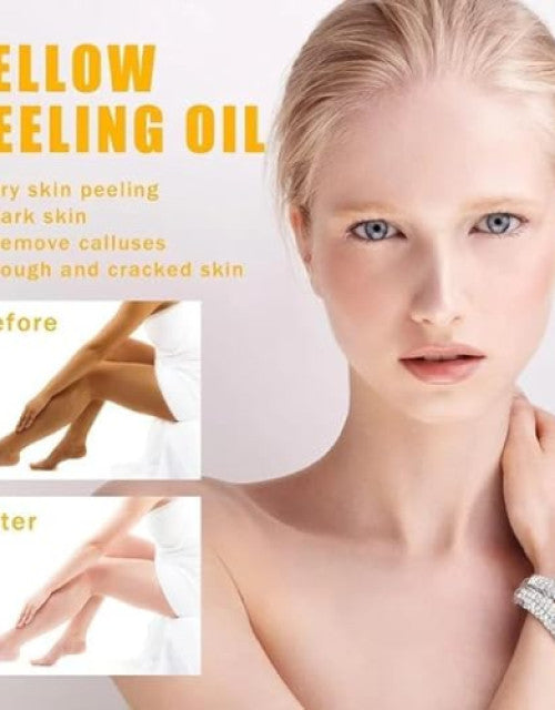 Yellow Peel Oil Free Post Peel Neutralizer | Naturally Removes Dead Skin Layer ( Pack Of1 1)